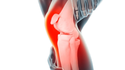 ACL Injury Specialist Doctor